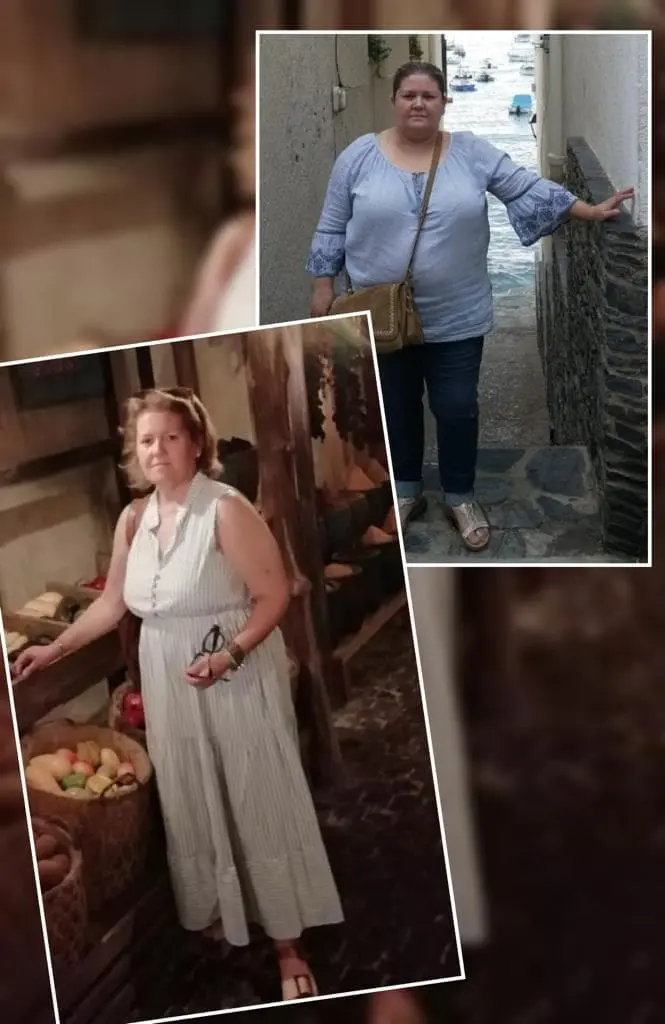 Testimonio paciente Cirugía Bariátrica pérdida de peso en Castellón Valencia
